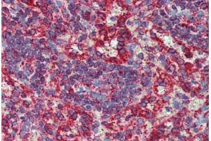 Spleen, Human: Formalin-Fixed, Paraffin-Embedded (FFPE)