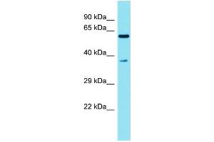 Host: Rabbit Target Name: C3orf30 Sample Type: Fetal Liver lysates Antibody Dilution: 1.
