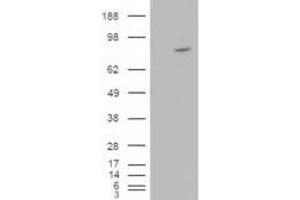 HEK293 overexpressing ARHGEF4 (ABIN5377068) and probed with ABIN185088 (mock transfection in first lane). (ARHGEF4 anticorps  (N-Term))