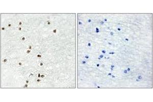Immunohistochemistry analysis of paraffin-embedded human brain tissue, using ZIC1/2/3 Antibody. (ZIC1/2/3 anticorps  (AA 316-365))