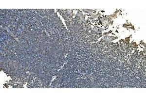 IHC analysis of LSM8 using anti-LSM8 antibody (ABIN7599579). (NAA38 anticorps  (AA 1-96))