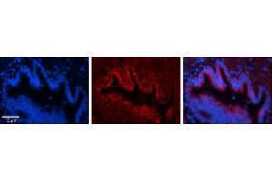 Rabbit Anti-UQCR10 Antibody     Formalin Fixed Paraffin Embedded Tissue: Human Bronchial Epithelial Tissue  Observed Staining: Cytoplasmic  Primary Antibody Concentration: 1:100  Other Working Concentrations: 1/600  Secondary Antibody: Donkey anti-Rabbit-Cy3  Secondary Antibody Concentration: 1:200  Magnification: 20X  Exposure Time: 0. (UQCR10 anticorps  (Middle Region))