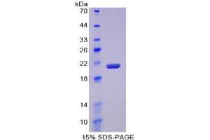 SDS-PAGE analysis of Mouse MMP12 Protein. (MMP12 Protéine)