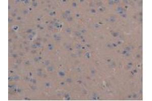 IHC-P analysis of Mouse Liver Tissue, with DAB staining. (MAP6 anticorps  (AA 177-387))