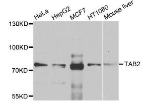 Western blot analysis of extracts of various cell lines, using TAB2 antibody (ABIN6003599) at 1/1000 dilution. (TAB2 anticorps)
