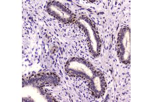 IHC analysis of NFIB/NF1B2 using anti-NFIB/NF1B2 antibody .