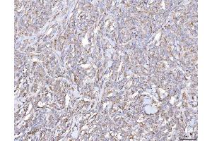 IHC analysis of PLP2 using anti-PLP2 antibody (ABIN7600320).