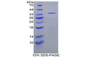 SDS-PAGE (SDS) image for Chemokine (C-X-C Motif) Ligand 5 (CXCL5) (AA 38-114) protein (His tag,GST tag) (ABIN1879950)