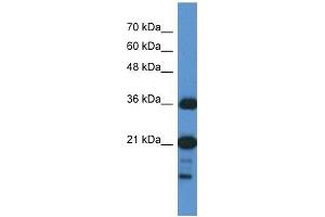 C1orf144 antibody used at 1 ug/ml to detect target protein. (C1orf144 anticorps  (N-Term))