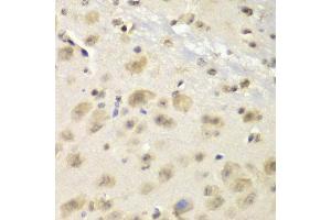 Immunohistochemistry of paraffin-embedded mouse brain using S100A10 antibody at dilution of 1:100 (x40 lens). (S100A10 anticorps)