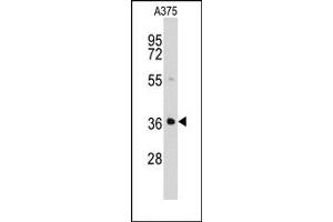 Image no. 3 for anti-Aldo-Keto Reductase Family 1, Member B1 (Aldose Reductase) (AKR1B1) (AA 287-316), (C-Term) antibody (ABIN357880)