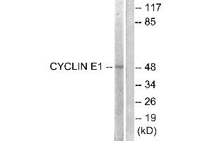 Western blot analysis of extracts from HeLa cells, treated with Paclitasel (1uM, 60mins), using Cyclin(Ab-395) antibody (#B0069, Line 1 and 2). (Cyclin E1 anticorps  (Thr395))