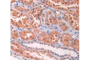 IHC-P analysis of kidney tissue, with DAB staining. (IL13 Receptor alpha 1 anticorps  (AA 203-376))