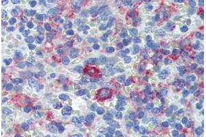 Spleen, Human: Formalin-Fixed, Paraffin-Embedded (FFPE) (CD163 anticorps)