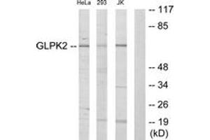 Western blot analysis of extracts from HeLa/293/Jurkat cells, using GK2 Antibody. (GK2 anticorps  (AA 281-330))
