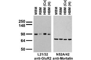 Immunoblot against crude membrane fractions from whole mouse (MBM) or rat (RBM) brain and from human cerebral cortex [HBM(Cx)] or hippocampus [HBM(H)] and probed with L21/32 (left) or N52A/42.
