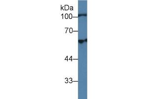 anti-Hexosaminidase B (Beta Polypeptide) (HEXB) (AA 122-311) antibody