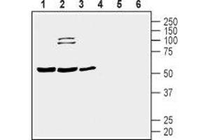 Western blot analysis of human Jurkat T-cell leukemia cell (lanes 1 and 4), human THP-1 monocytic leukemia cell (lanes 2 and 5) and human MEG-01 megakaryoblastic leukemia cell (lanes 3 and 6) lysates: - 1-3. (Prostacyclin Receptor anticorps  (3rd Extracellular Loop))