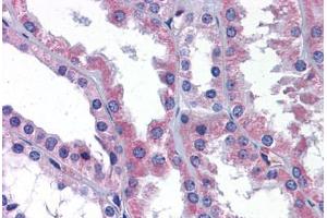 Human Kidney: Formalin-Fixed, Paraffin-Embedded (FFPE) (AKT3 anticorps  (AA 119-136))