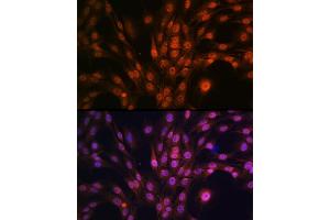 Immunofluorescence analysis of C6 cells using P antibody (ABIN7269146) at dilution of 1:100. (PAK2 anticorps)