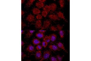 Confocal immunofluorescence analysis of HeLa cells using RPL30 antibody (ABIN6130903, ABIN6147135, ABIN6147136 and ABIN6217777) at dilution of 1:200.