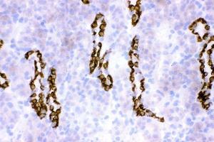 IHC analysis of HSD11B2 using anti-HSD11B2 antibody (ABIN3043846). (HSD11B2 anticorps  (C-Term))