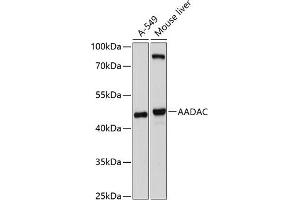 Western blot analysis of extracts of various cell lines, using AADAC antibody (ABIN6129181, ABIN6136310, ABIN6136312 and ABIN6214595) at 1:1000 dilution. (AADAC anticorps  (AA 170-399))