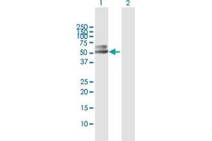 Western Blot analysis of PSAP expression in transfected 293T cell line by PSAP MaxPab polyclonal antibody. (Prosaposin anticorps  (AA 1-524))