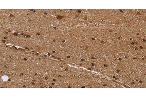 Immunohistochemistry of paraffin-embedded Human brain using EIF3H Polyclonal Antibody at dilution of 1:50