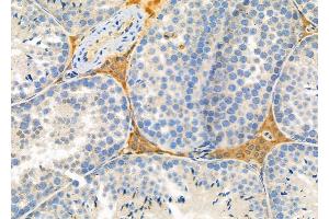 ABIN6261666 and ABIN6278759 at 1/100 staining Mouse testis tissue by IHC-P.