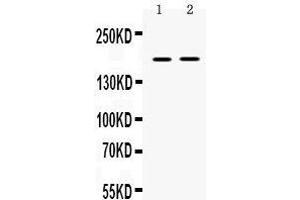 Western blot analysis of Ceruloplasmin expression in rat skeletal muscle extract (lane 1), and NIH3T3 whole cell lysates (lane 2). (Ceruloplasmin anticorps  (AA 20-258))