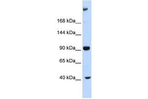 WB Suggested Anti-MPDZ Antibody Titration:  0. (MPDZ anticorps  (Middle Region))