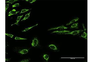 Immunofluorescence of purified MaxPab antibody to HSPD1 on HeLa cell.