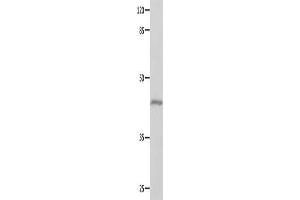 Gel: 10 % SDS-PAGE, Lysate: 40 μg, Lane: Mouse eyes tissue, Primary antibody: ABIN7129618(GNA11 Antibody) at dilution 1/550, Secondary antibody: Goat anti rabbit IgG at 1/8000 dilution, Exposure time: 10 seconds (GNA11 anticorps)