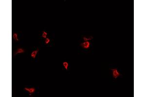 ABIN6266735 staining HepG2  cells by IF/ICC.