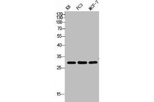 Western Blot analysis of KB PC-3 MCF7 cells using ApoF Polyclonal Antibody (Apolipoprotein F anticorps  (C-Term))