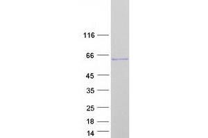 Septin 8 (SEPT8) (Transcript Variant 1) protein (Myc-DYKDDDDK Tag)