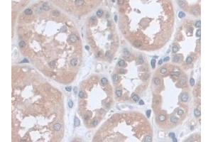 Detection of UCP2 in Human Kidney Tissue using Monoclonal Antibody to Mitochondrial Uncoupling Protein 2 (UCP2)