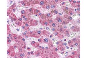 Immunohistochemistry (IHC) image for anti-Glutathione S-Transferase mu 1 (GSTM1) (C-Term) antibody (ABIN2776985)