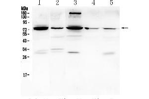 Western blot analysis of PTGS2 using anti- PTGS2 antibody . (PTGS2 anticorps  (Middle Region))