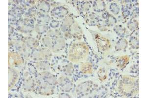 Immunohistochemistry of paraffin-embedded human pancreatic tissue using ABIN7150385 at dilution of 1:100 (RFX6 anticorps  (AA 1-260))