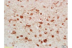 Formalin-fixed and paraffin embedded rat brain labeled with Anti-Calretinin/CA Polyclonal Antibody, Unconjugated (ABIN724355) followed by conjugation to the secondary antibody and DAB staining (Calretinin anticorps  (AA 211-271))