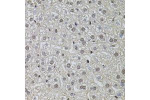 Immunohistochemistry of paraffin-embedded mouse liver using POP4 antibody. (RPP29 anticorps)