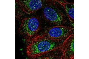 Immunofluorescent staining of MCF7 cells with NDUFS3 polyclonal antibody  (Green) shows positivity in nucleus and mitochondria. (NDUFS3 anticorps)