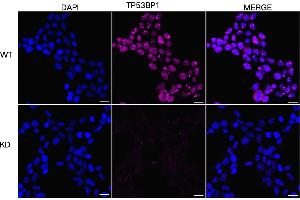 Immunocytochemical staining of HeLa cells using TP53BP1 antibody (ABIN7800690), 1:1,000), Top panel: wild-type (WT), Bottom panal: TP53BP1 shRNA knockdown (KD). (TP53BP1 anticorps)