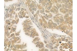 ABIN6257879 and ABIN6275537 at 1/100 staining human normal kidney tissue by IHC-P. (PRKX anticorps  (Internal Region))
