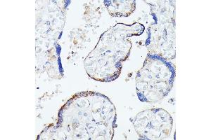 Immunohistochemistry of paraffin-embedded human placenta using HSPB11 antibody (ABIN7267591) at dilution of 1:100 (40x lens).