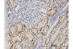 Immunoperoxidase of monoclonal antibody to SLC22A6 on formalin-fixed paraffin-embedded human kidney.
