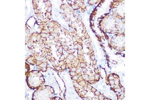 Immunohistochemistry of paraffin-embedded mouse kidney using NDRG1 Rabbit mAb (ABIN7268783) at dilution of 1:100 (40x lens).