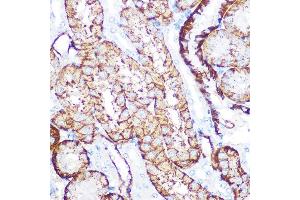 Immunohistochemistry of paraffin-embedded mouse kidney using NDRG1 Rabbit mAb (ABIN7268783) at dilution of 1:100 (40x lens). (NDRG1 anticorps)